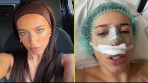 Exchica reality se sometió a cirugía nasal y podría perder el olfato: 'Me siento bastante deprimida'
