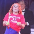 Pastelito de Chile mostró en redes sociales el proceso previo a su implante capilar. El artista circense compartió imágenes de su cambio de look y bromeó sobre su calvicie.