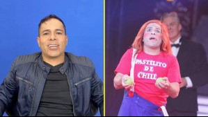'Me pusieron Toretto': Pastelito de Chile mostró su radical cambio antes de someterse a implante capilar