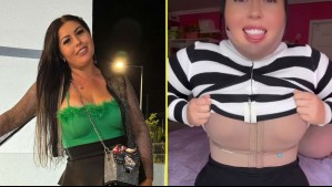 Camila Arismendi sorprende mostrando su recuperación tras cirugía estética: Se realizó una lipoescultura