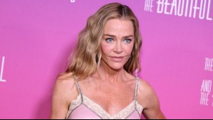 Denise Richards muestra el impactante resultado de su rejuvenecimiento facial: Así luce tras someterse a complejas cirugías