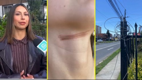 'Me pudo costar la vida': Joven de Temuco denuncia que cable en desuso se enredó en su cuello mientras iba en bicicleta