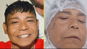 'Solo Dios sabe si vivo después de esto': Conocido cantante urbano chileno preocupa tras revelar grave estado de salud