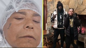 'Aún nadie sabe si vivo': JB The Voice revela que estuvo 'a punto de morir' y entrega detalles de su estado de salud