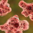 Una niña de ocho años falleció en Louisiana, Estados Unidos, tras contraer una mortal infección conocida popularmente como la ?ameba comecerebros, habría estado expuesta al organismo mientras se bañaba en un lago de agua dulce.