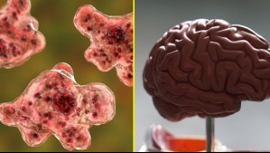 Tragedia en Estados Unidos: Niña de 8 años muere tras infectarse con la 'ameba comecerebros'