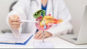 EEUU aprueba prometedor tratamiento para cáncer de páncreas