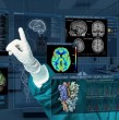 Un importante avance en la medicina se registró en Reino Unido, donde un equipo de especialistas realizó con éxito la primera neurocirugía asistida por inteligencia artificial (IA) en tiempo real.