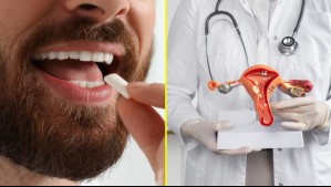 El chicle que podría ayudar a combatir el virus del papiloma humano: Estudio logra reducirlo hasta 93%