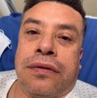 El cantante nacional encendió las alarmas tras revelar el difícil cuadro que afectó su rostro de un momento a otro. Conoce todos los detalles en la siguiente nota.