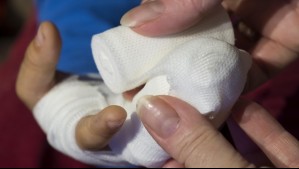 Mujer sufre heridas de gravedad tras ataque de dos perros en Puerto Montt: Podría perder la movilidad de una de sus manos