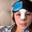 Skarleth Labra mostró en redes sociales el resultado de su rinoseptoplastia y contó que llevaba tiempo evaluando la intervención, además de compartir detalles de su recuperación.