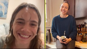 Le apareció una gran inflamación en su frente: María Gracia Omegna muestra cómo reaccionó su cuerpo tras picadura de bicho