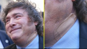 El extraño parche de Milei y la explicación que dieron desde el gobierno argentino
